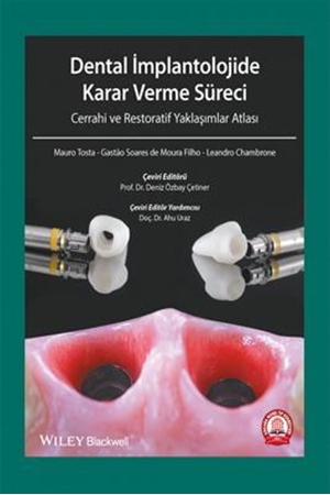 Resim Dental İmplantolojide Karar Verme Süreci Cerrahi Atlası