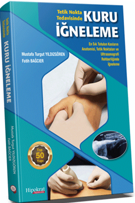 resm Tetik Nokta Tedavisinde Kuru İğneleme