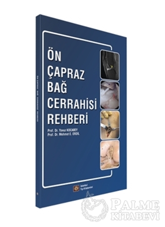 Resim Ön Çapraz Bağ Cerrahisi Rehberi