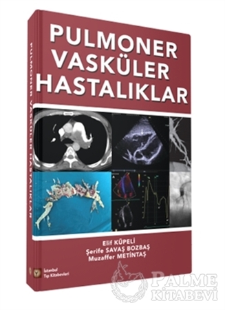 Resim Pulmoner Vasküler Hastalıklar