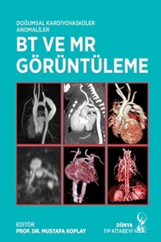 resm Doğumsal Kardiyovasküler Anomaliler BT ve MR Görüntüleme