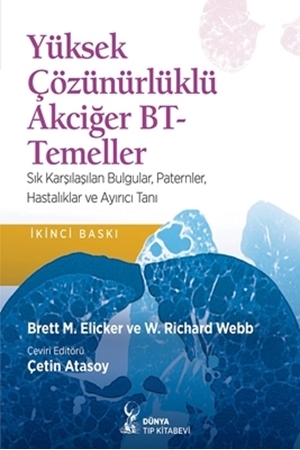 Resim Yüksek Çözürnüklü Akciğer BT Temeller