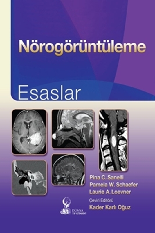 resm Nörogörüntüleme: Esaslar