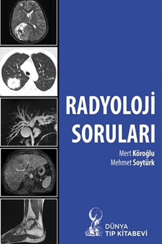 resm Radyoloji Soruları