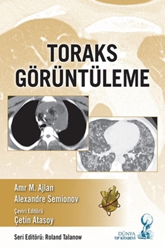 resm Toraks Görüntüleme