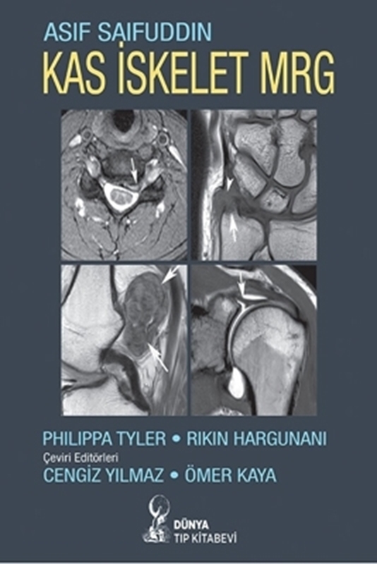 resm Kas İskelet MRG