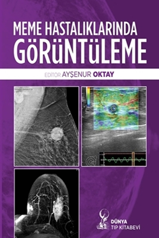 resm Meme Hastalıklarında Görüntüleme