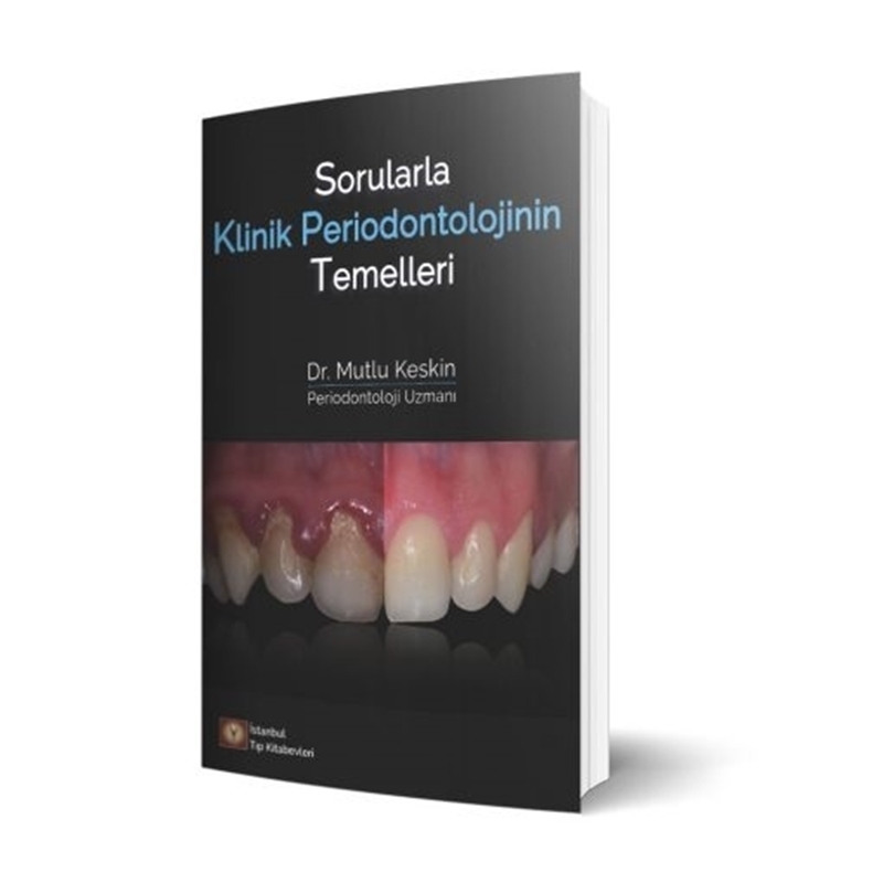 resm Sorularla Klinik Periodontolojinin Temelleri