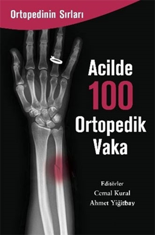 resm Acilde 100 Ortopedik Vaka Zinde Yayıncılık