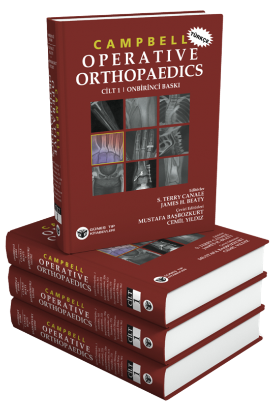 resm Campbell's Operative Orthopaedics 4 Cilt Türkçesi