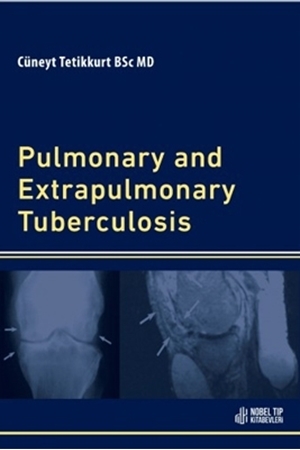 Resim Pulmonary and Extrapulmonary Tuberculosis