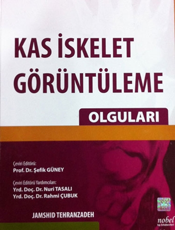 Resim Kas İskelet Görüntüleme Olguları