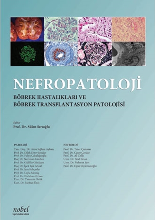 Resim Nefropatoloji: Böbrek Hastalıkları ve Böbrek Transplantasyon Patolojisi