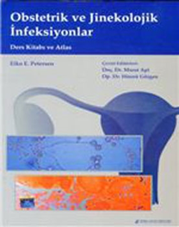 Resim Obstetrik ve Jinekolojik İnfeksiyonlar