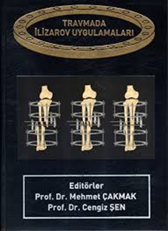 Resim Travmada İlizarov Uygulamaları