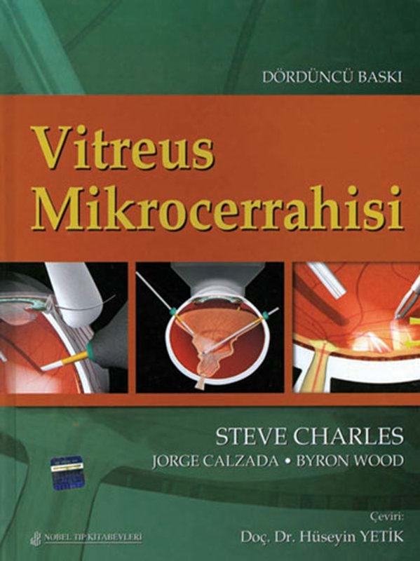 resm Vitreus Mikrocerrahisi
