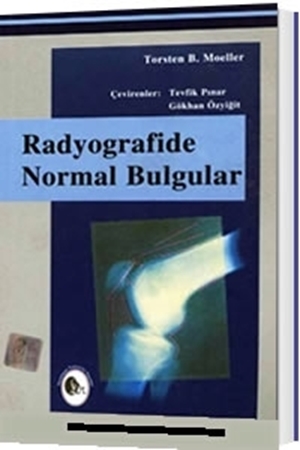 Resim Radyografide Normal Bulgular