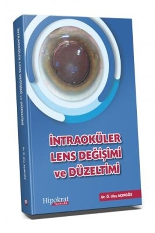 resm İntraoküler Lens Değişimi ve Düzeltimi