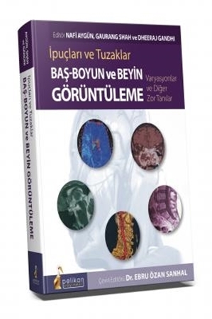 Resim İpuçları ve Tuzaklar Baş - Boyun ve Beyin Görüntüleme