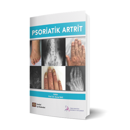 Resim Psoriatik Artrit