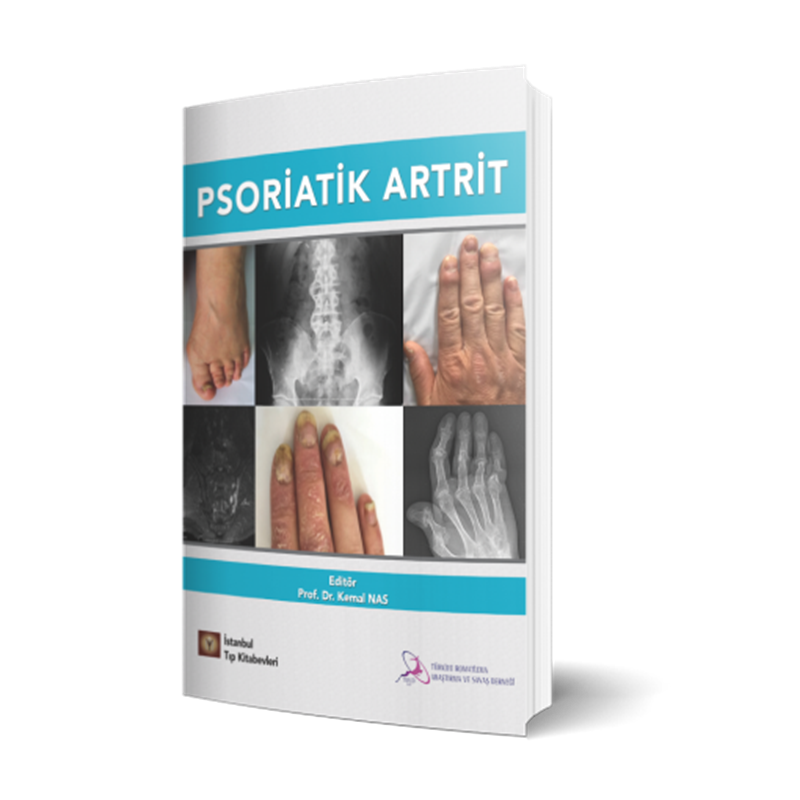 resm Psoriatik Artrit