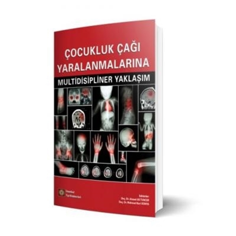 resm Çocukluk Çağı Yaralanmalarına Multidisipliner Yaklaşım