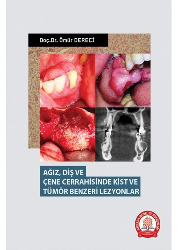 resm Ağız Diş ve Çene Cerrahisinde Kist ve Tümör Benzeri Lezyonlar