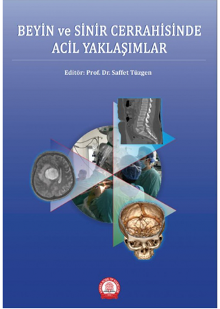 Resim Beyin ve Sinir Cerrahisinde Acil Yaklaşımlar