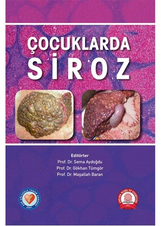 Resim Çocuklarda Siroz