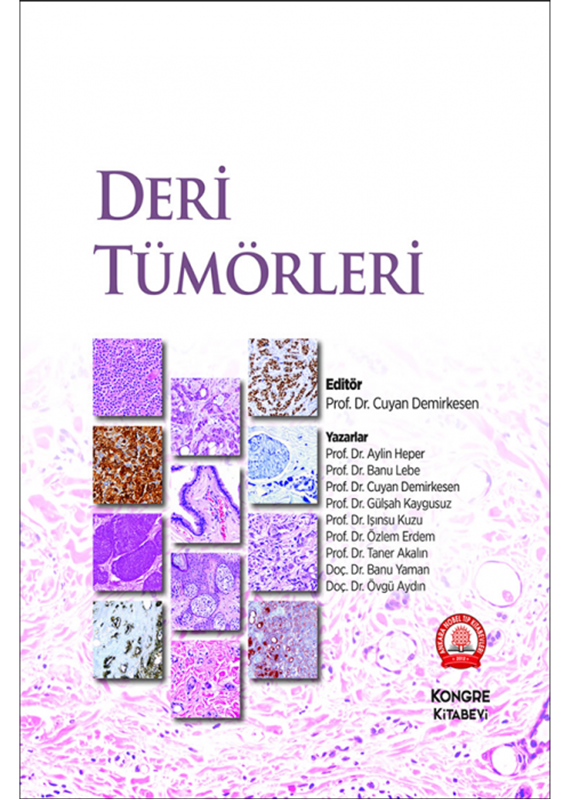 resm Deri Tümörleri