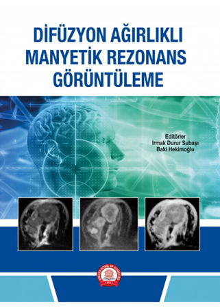 Resim Difüzyon Ağırlıklı Manyetik Rezonans Görüntüleme