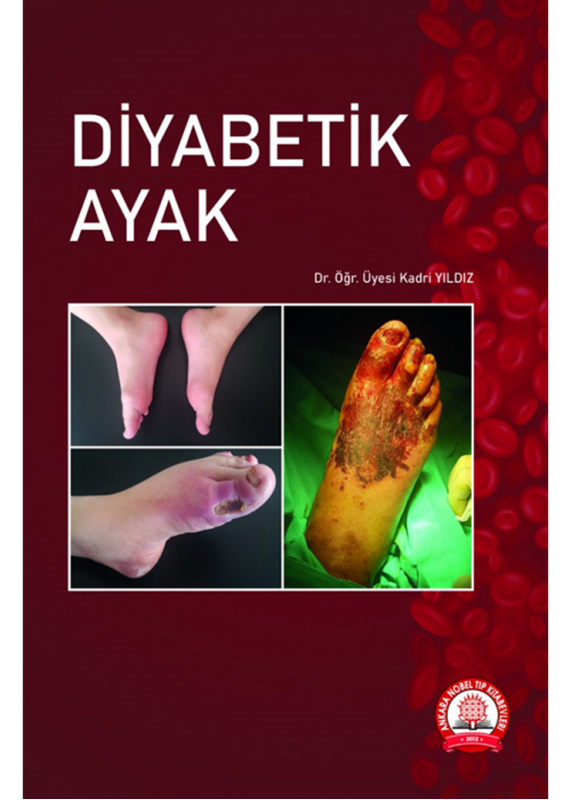 resm Diyabetik Ayak