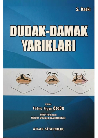 Resim Dudak Damak Yarıkları