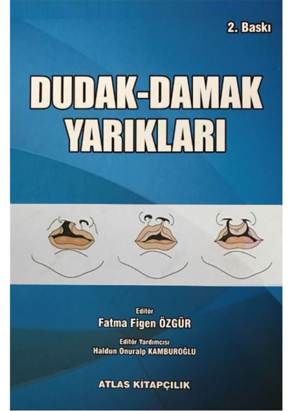 resm Dudak Damak Yarıkları