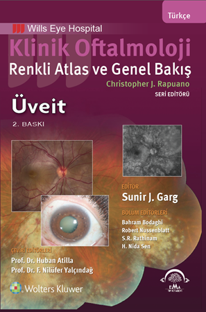Resim Klinik Oftalmoloji Renkli Atlas ve Genel Bakış - ÜVEİT