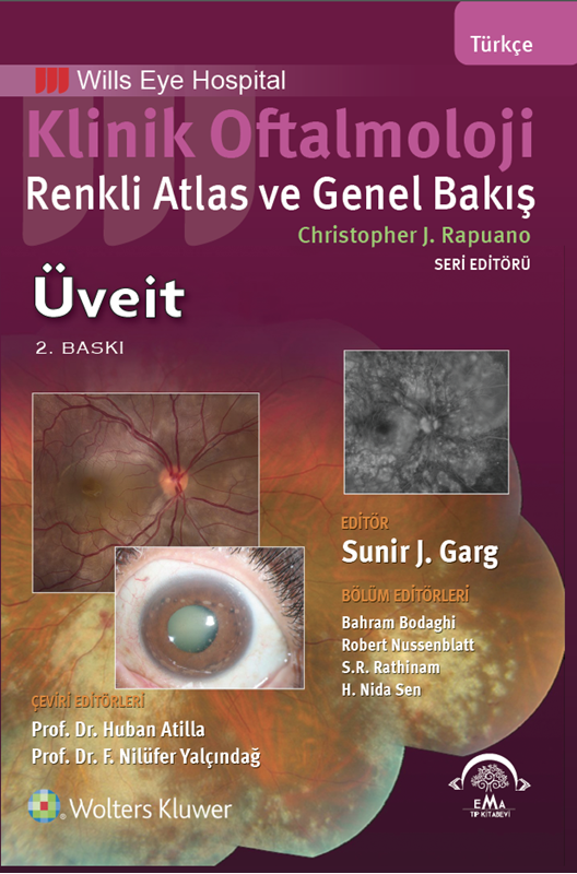 resm Klinik Oftalmoloji Renkli Atlas ve Genel Bakış - ÜVEİT