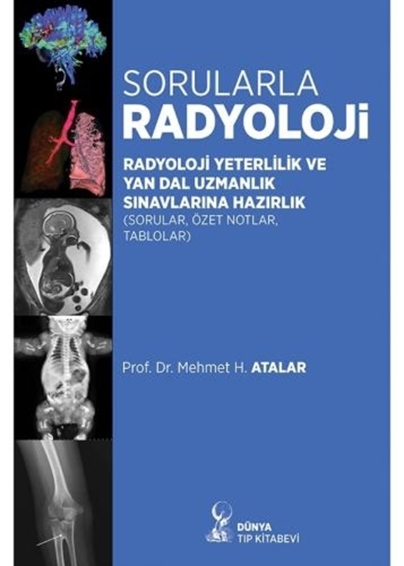 resm Sorularla Radyoloji