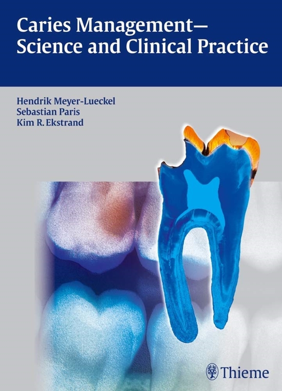 resm Caries Management - Science and Clinical Practice