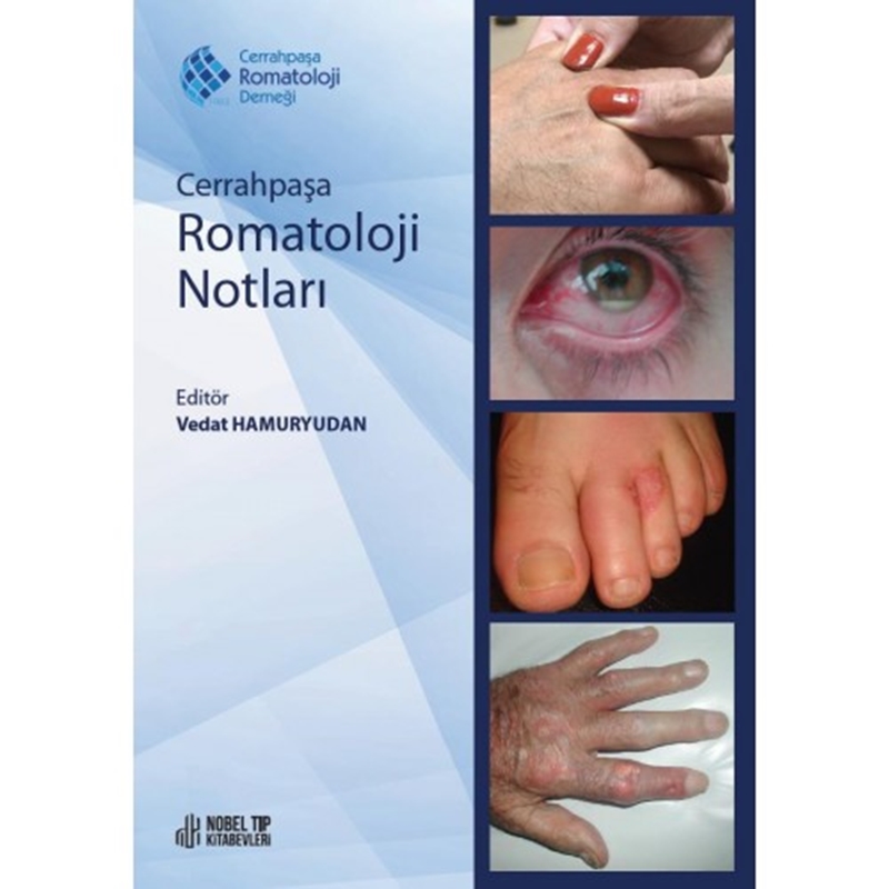 resm Cerrahpaşa Romatoloji Notları