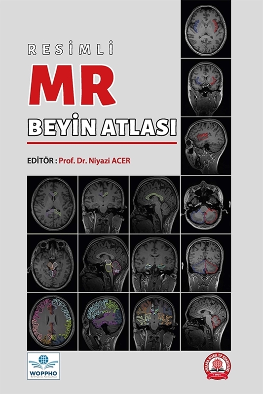 resm Resimli MR Beyin Atlası
