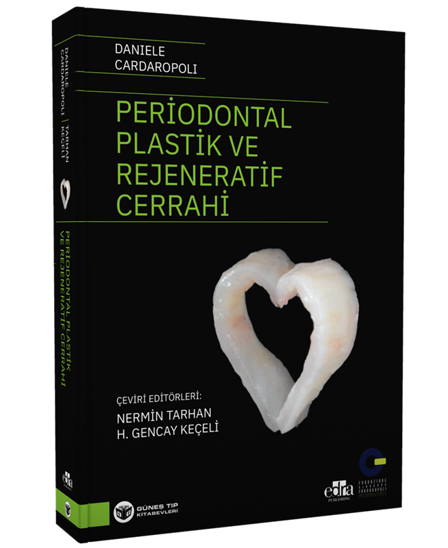 resm Periodontal Plastik ve Rejeneratif Cerrahi