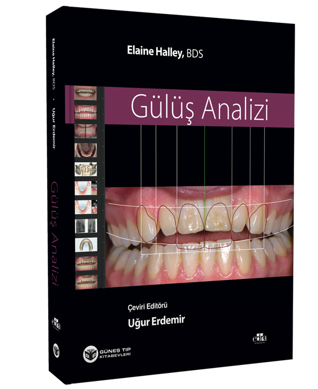 resm Gülüş Analizi