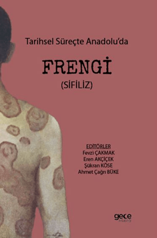 resm Tarihsel Süreçte Anadolu’da Frengi