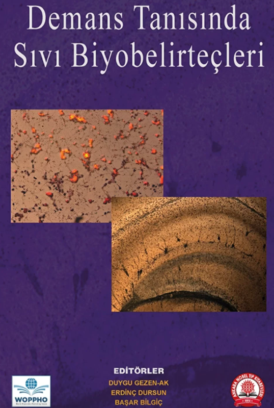 resm Demans Tanısında Sıvı Biyobelirteçler