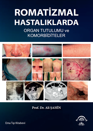 Resim Romatizmal Hastalıklarda Organ Tutulumu ve Komorbiditeler