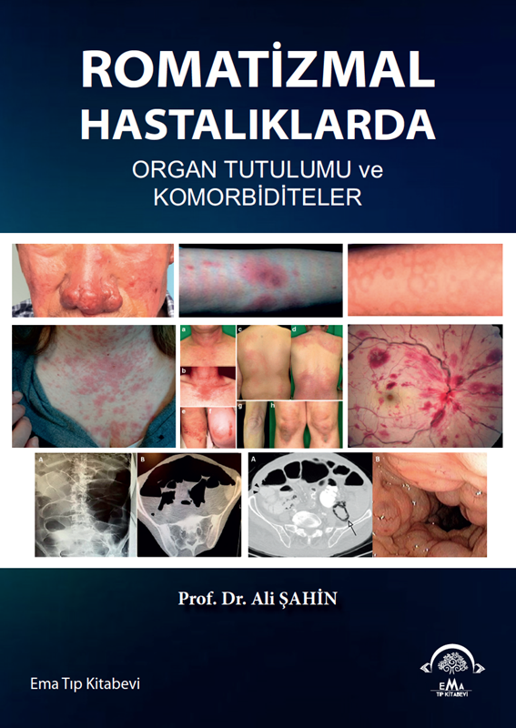resm Romatizmal Hastalıklarda Organ Tutulumu ve Komorbiditeler