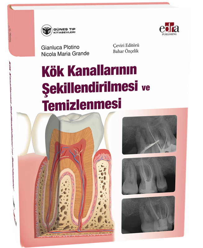 resm Kök Kanallarının Şekillendirilmesi ve Temizlenmesi