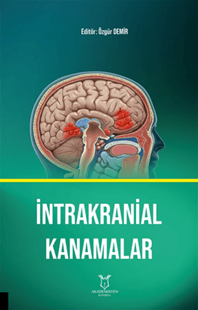 Resim İntrakranial Kanamalar