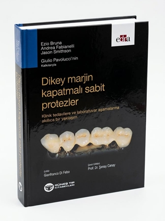 Resim Dikey Marjin Kapatmalı Sabit Protezler