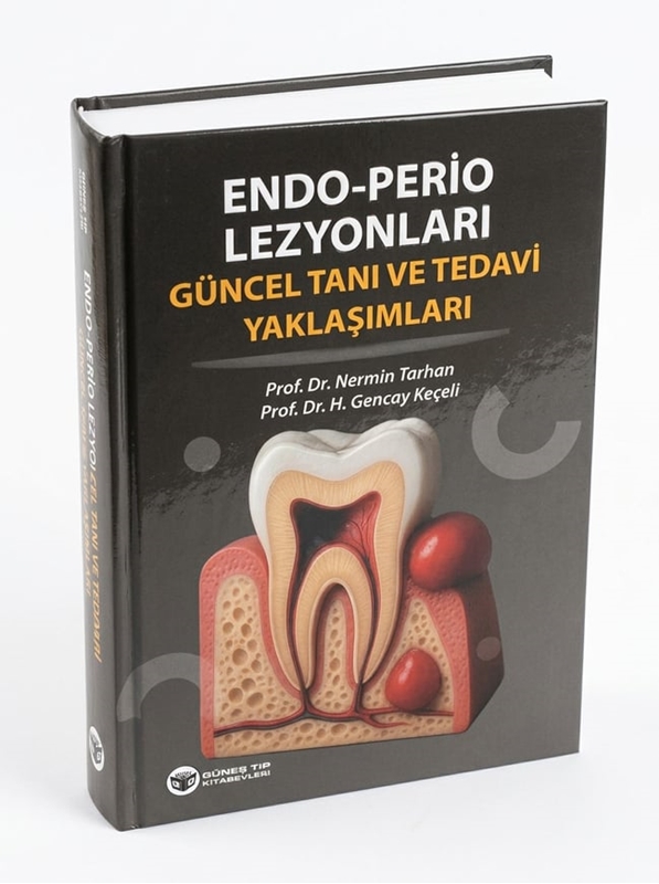 resm Endo - Perio Lezyonları Güncel Tanı ve Tedavi Yaklaşımları
